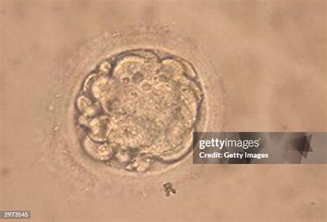 microscopic embryo   premium high res pictures getty images