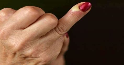Pus formation – expert tips for home treatment | TheHealthSite.com