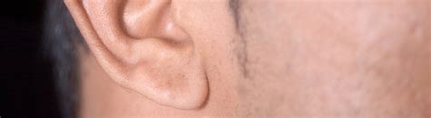 earlobe repair desert ear nose throat otolaryngology  rancho