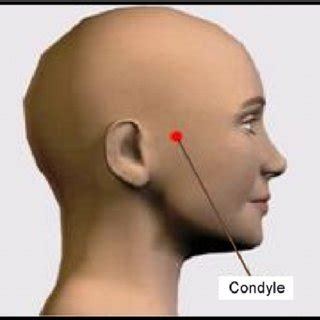 condyle location shown  red  scientific diagram