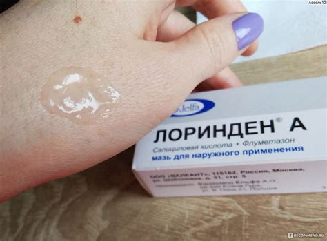 Отрубевидный лишай мазь для лечения