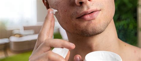 how to clean blackheads at home