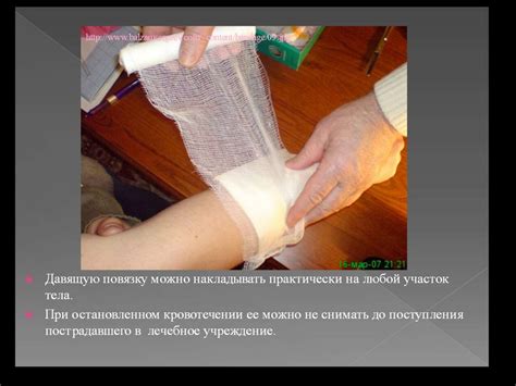Правила остановки артериального кровотечения - презентация онлайн