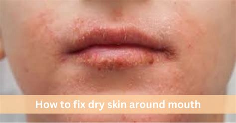 Effective Tips On How To Fix Dry Skin Around The Mouth