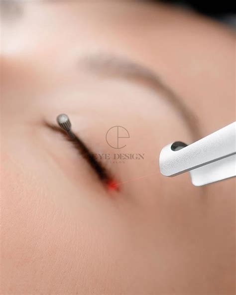 Remove Permanent Eyeliner: Benefits, Side Effects and Cost