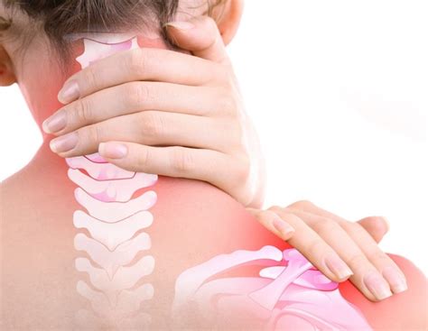 O Que Radiculopatia - O que é radiculopatia na coluna - ITC Vertebral