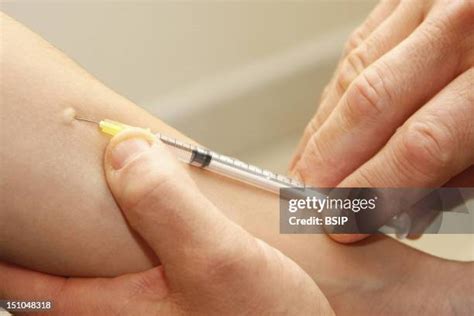 22 Tb Skin Test Stock Photos, High-Res Pictures, and Images - Getty Images