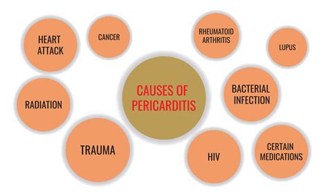 Pericarditis | The Harley Street