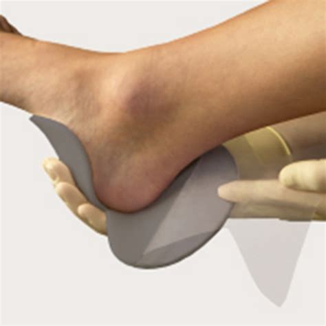 mepilex border ag antimicrobial dressing medical dressings