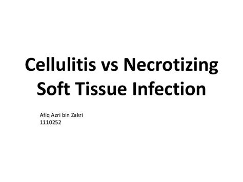 Cellulitis vs necrotizing soft tissue infection