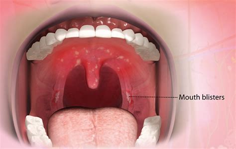 health condition symptoms  treatment