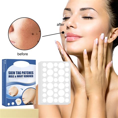 Skin Tag Remover Patches 144 PCS Natural Safe Mole & Wart Removal ...