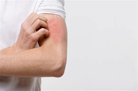 O que é alergia emocional? Conheça causas e sintomas