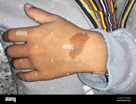 Irregular marks hi-res stock photography and images - Alamy