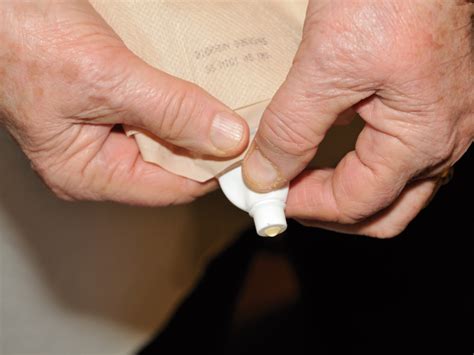 urostomy find   urostomy bag   type  braun