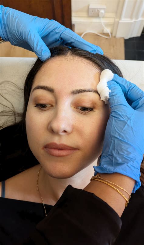 Brazilian Butt Lift London - Harley Street - Free Consultation