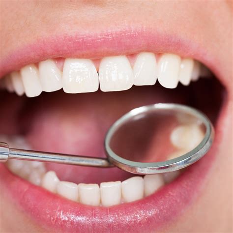 pearl dental care