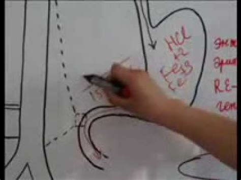 Төмөр дутлын цус багадалт эмгэгжам ЗЭФ iron deficiency anemia - YouTube