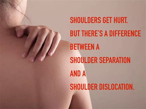 Shoulder Separations are NOT Shoulder Dislocations | PDF