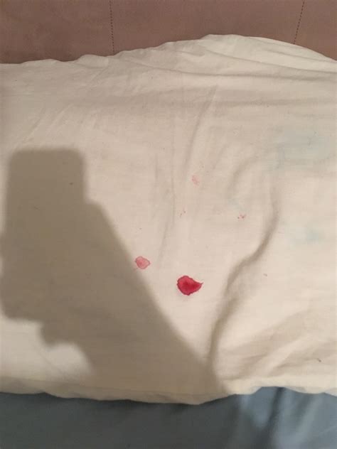 Good morning pillow... : r/eczema