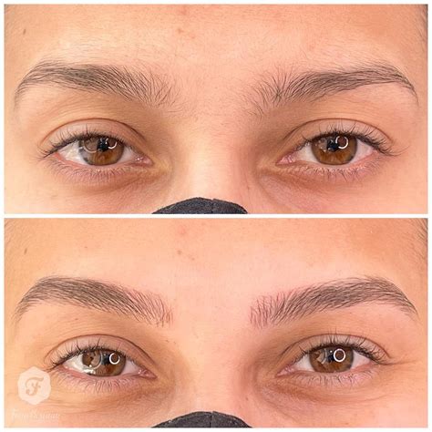 Antes E Depois De Micropigmentação De Sobrancelhas
