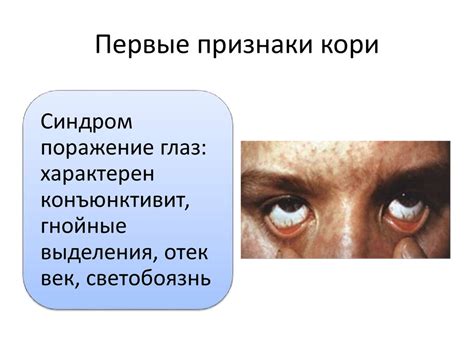 Корь: клиническая диагностика. Противоэпидемические мероприятия ...