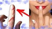Как избавиться от заусениц | Простой метод - YouTube
