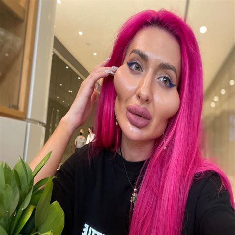 world biggest cheeks of anastasia pokreshchuk - વિશ્વમાં સૌથી મોટા ગાલ