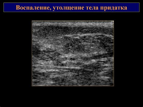 Ультразвуковая диагностика заболеваний органов мошонки - презентация онлайн