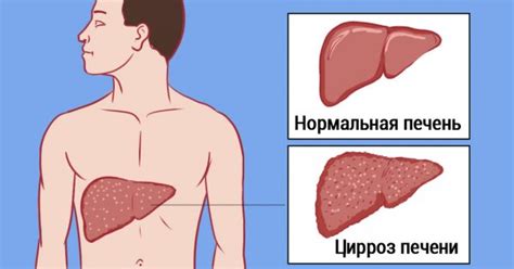 Как навсегда удалить возрастные пигментные пятна: действенное домашнее ...