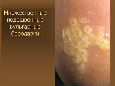 Вирусные дерматозы - презентация онлайн