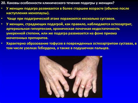 Подагра. Подагрический артрит - презентация онлайн