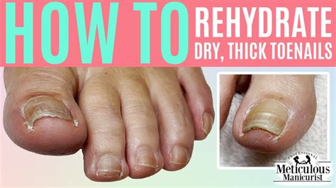 Best Treatment For Dry Brittle Toenails | edu.svet.gob.gt