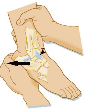 Posterior Drawer Test Of The Ankle - OrthoFixar 2021