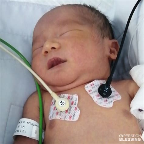 A Miracle Baby in China - Operation Blessing