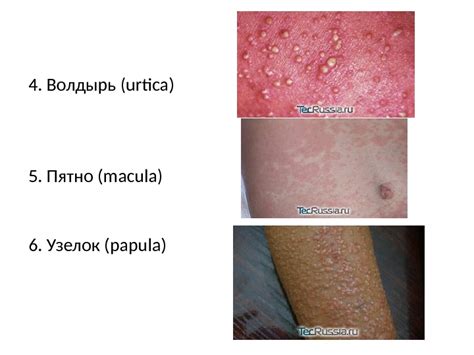 Презентация Кожные заболевания и их профилактика