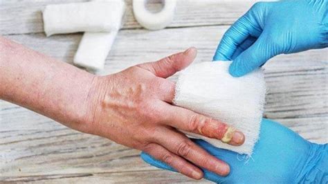 phlegmon tribunnewswikicom