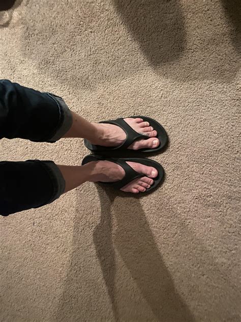 Do any males have pictures of their bunions to share? : bunions