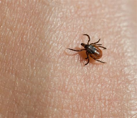 Tick diseases - cqluli