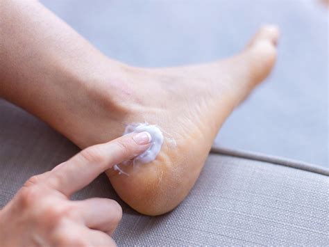 Ways To Heal Cracked Feet Online | www.repc.com