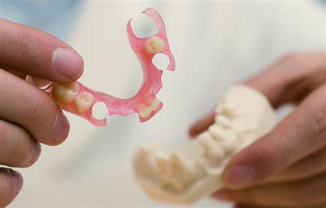 Valplast Dentures: Flexibility & Comfort | Wimbledon SW19