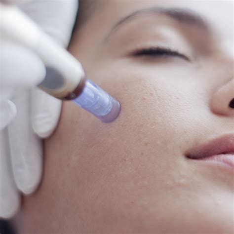 Skin Needling – Aurora Online Store