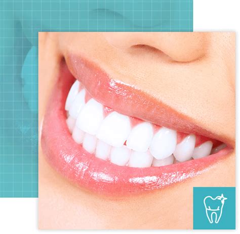 Cosmetic Teeth Whitening – Langley Family Dentistry