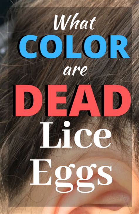 Dead vs Live Nits: Color of Lice Eggs - My Lice Advice