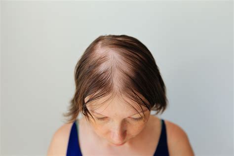 Public opinion on the balding old man look is shifting rapidly 4