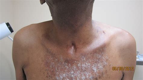 Derm Challenge
