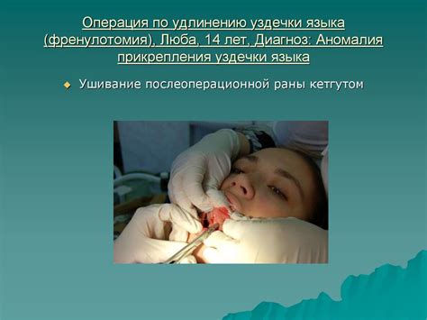 Амбулаторные операции в полости рта - online presentation