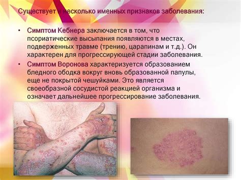 Аутоиммунные заболевания кожи - online presentation