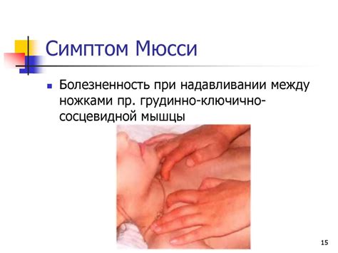 АФО органов пищеварения, мочеотделения, кроветворения, эндокринной ...