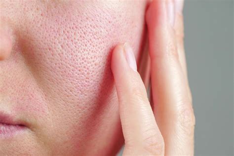 How To Unclog Your Pores